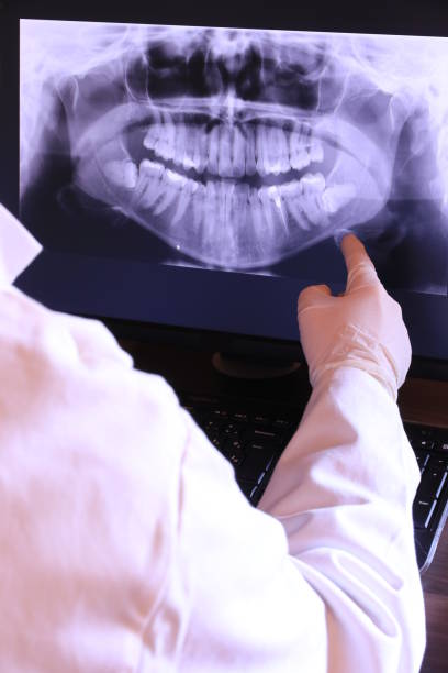 Dentist for Dental Trauma in LA