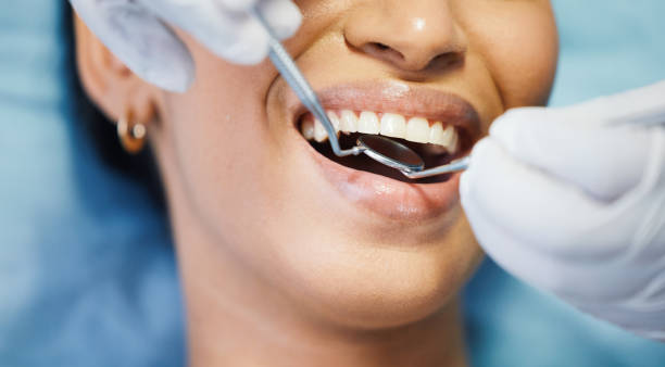 Best Emergency Gum Pain Relief  in Charenton, LA